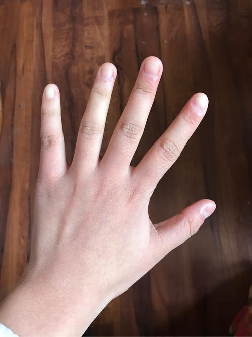 手短的男人说明了什么