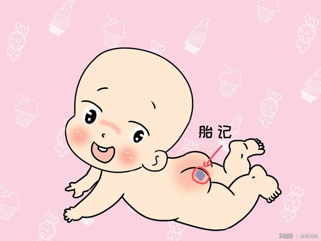 屁股上的胎记有什么意思