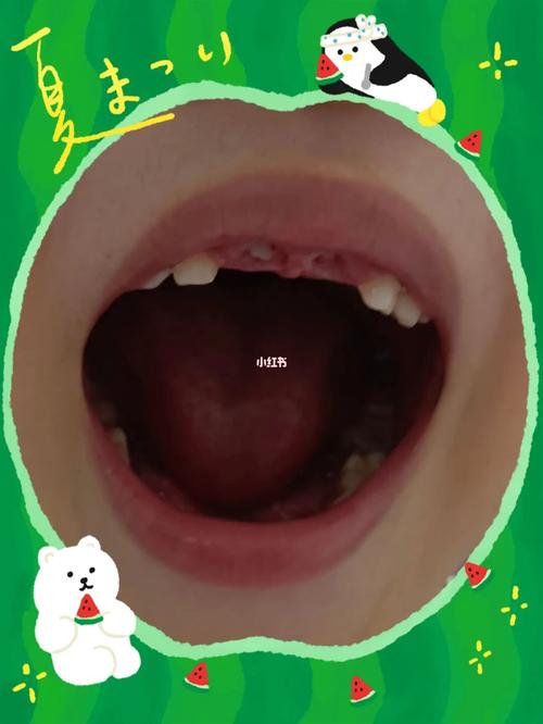 小孩梦到掉牙预示
