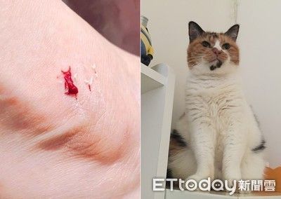 梦见脚脖子被猫咬出血