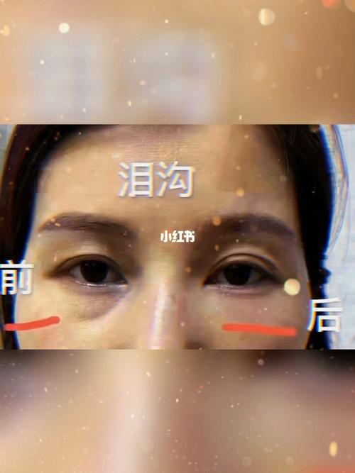 有泪窝好不好