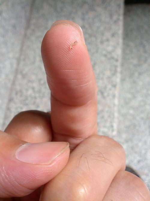 梦见从手心里拽出虫子是什么意思