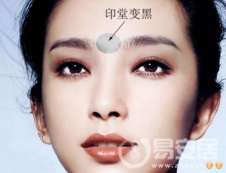 印堂发黑破解之法