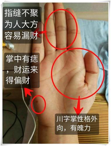 手上长痣,什么痣更利于财运