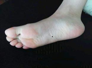 女人脚底有痣好不好？