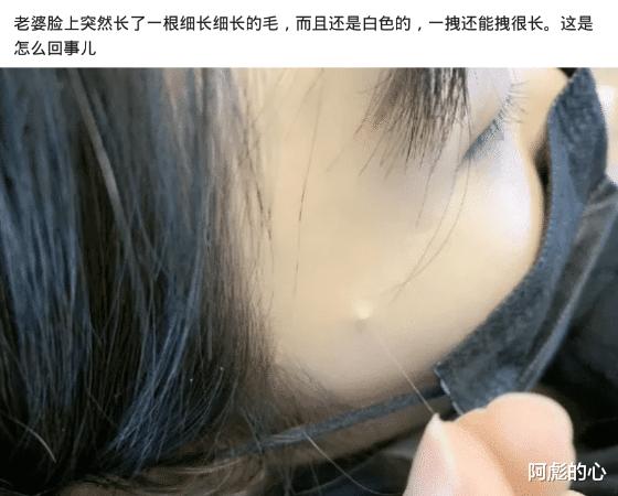 脸上长一根白毛寓意