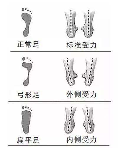 脚有这些特征的人的寿命通常比平常人要短