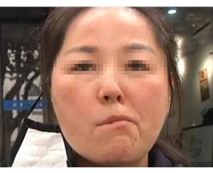 梦见嘴歪了 梦见我嘴歪了
