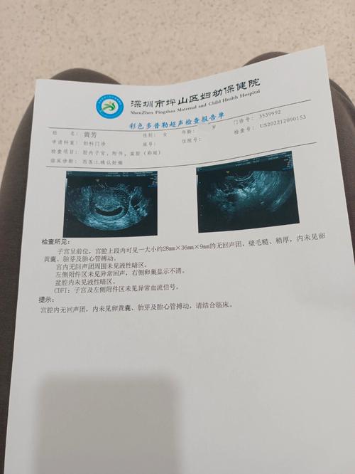 熊猫血可以药流吗