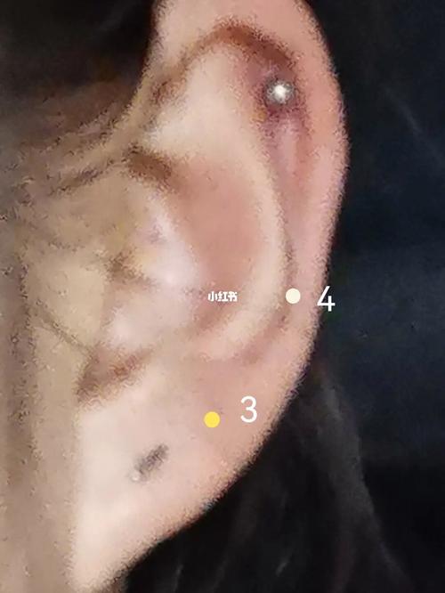 女人左耳耳背有痣好吗