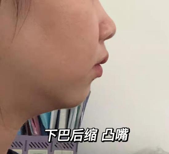 下巴小,下巴短代表什么意思?