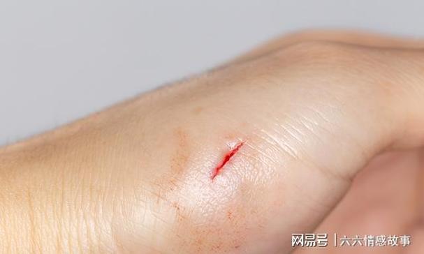 梦见老鼠咬死人
