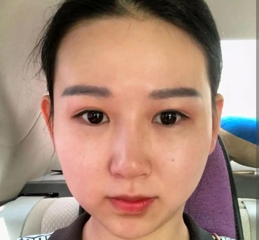 男人印堂凹陷代表什么含义