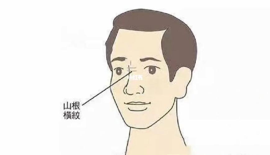 图解山根有黑线说明了什么