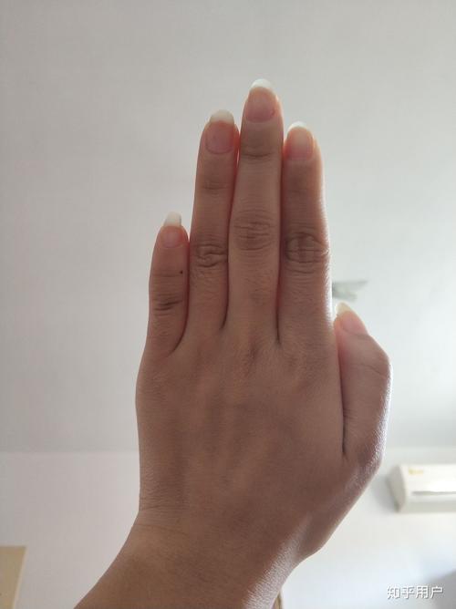 小姆手指短有什么特征