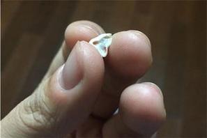 梦见牙垢掉了 周公解梦之梦到牙垢掉了