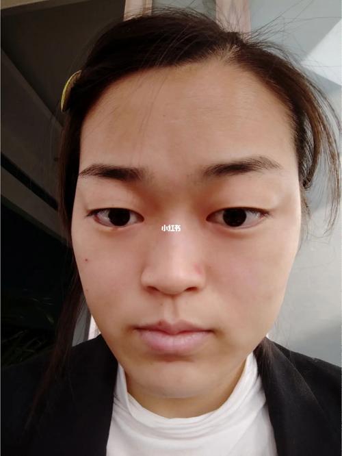死鱼眼的面相好不好