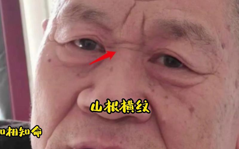 山根有横纹男人好不好
