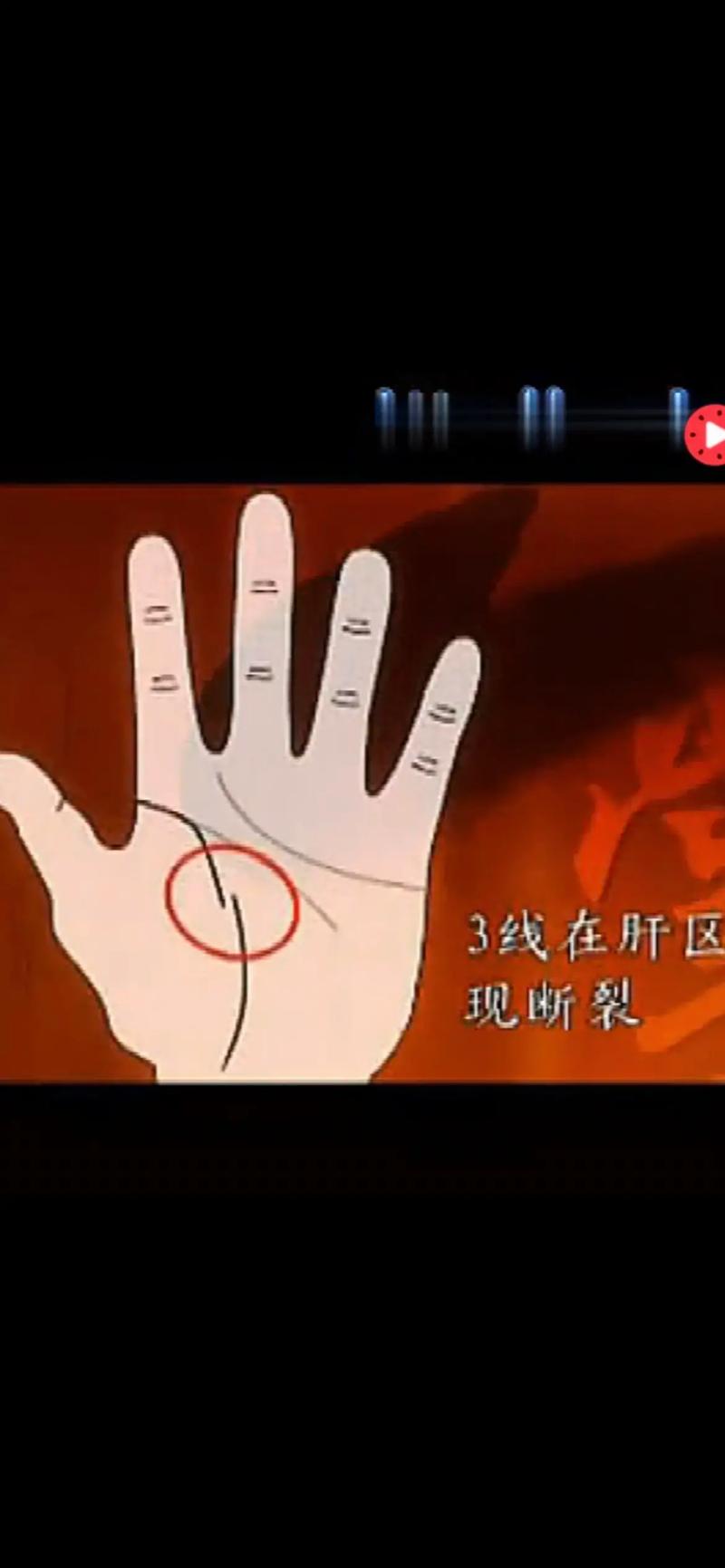 生命线断开3断的含义