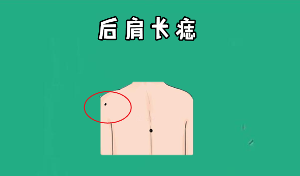 肩膀看你运气是好是坏