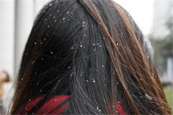 女人梦见头上长虱子什么意思