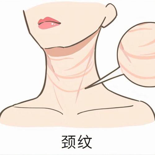 女人颈纹多是什么原因