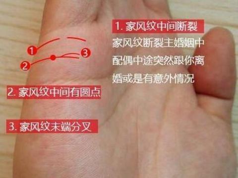 手掌伤痕是否对手相有影响