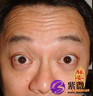 三条抬头纹的男人