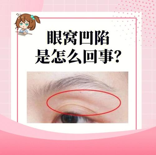 眼窝凹陷代表什么