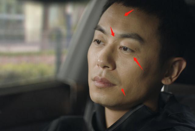 山根有疤的男人如何化解