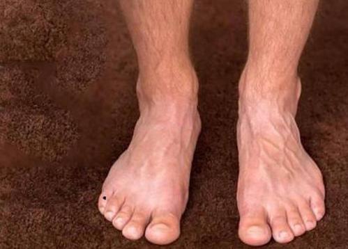 男人右脚小趾有痣,对待感情十分火热,持久度低