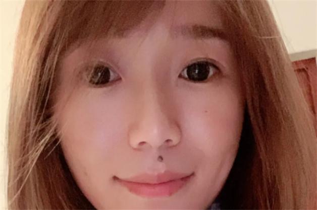 人中有痣的女人