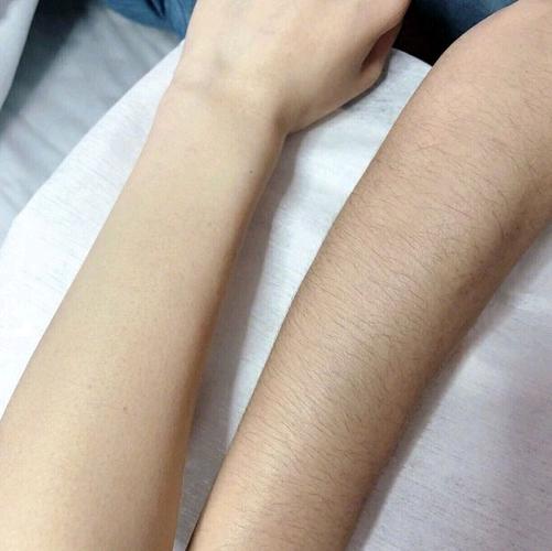 手臂汗毛长的女人面相