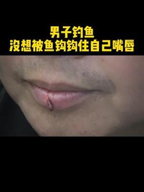 梦见鱼钩钩到自己嘴