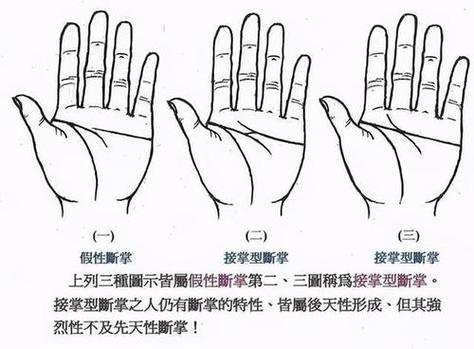 女孩右手断掌非富即贵