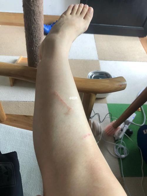 梦见腿上有伤口是什么意思