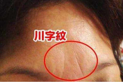 眉中间有一竖纹征兆