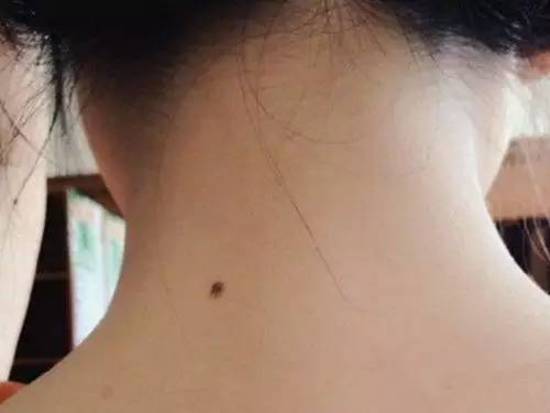 脸上有酒窝,脖身上有胎记,此四种人不能错过!