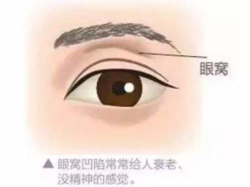 眼窝深陷的人是不是喜欢在背后说人长短