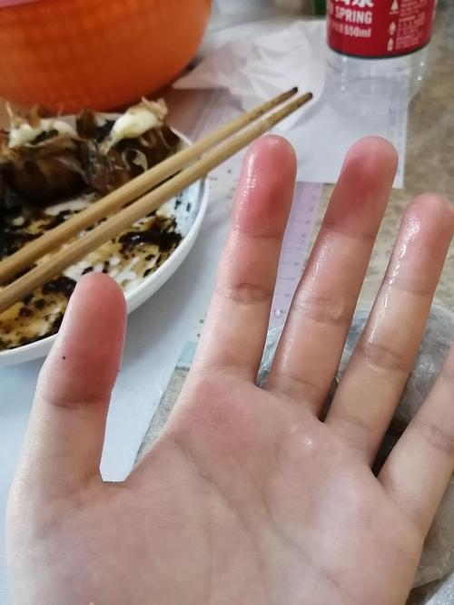 上香被烫了右手有什么预兆