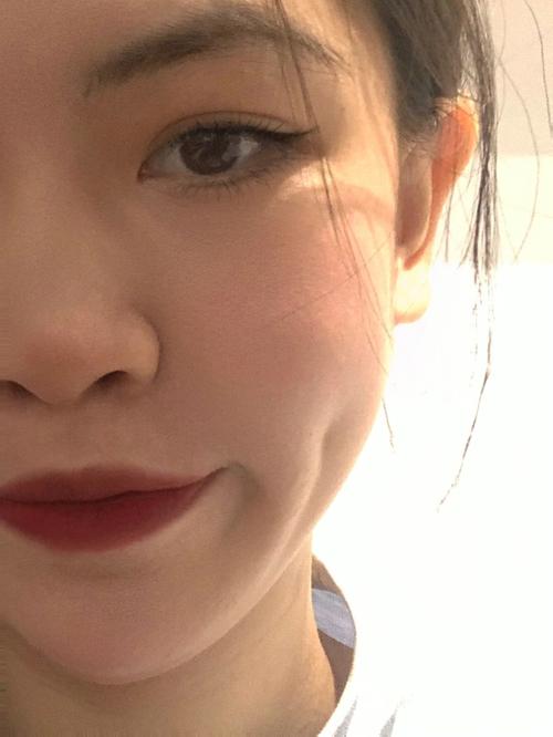 酒窝周围有痣代表了什么意思