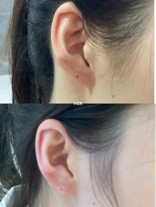 丰耳垂真的可以提运吗