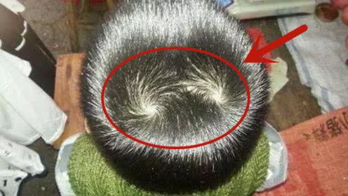 头上两个旋代表什么