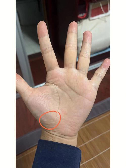 生命线怎么看出身体里隐藏的疾病