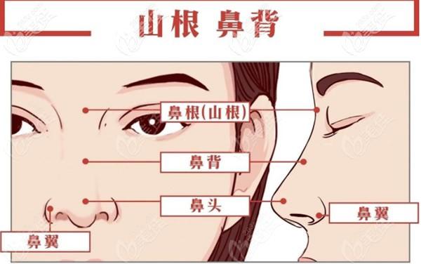山根是什么?
