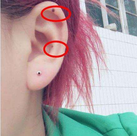 左耳耳廓有痣的女人是不是富贵命