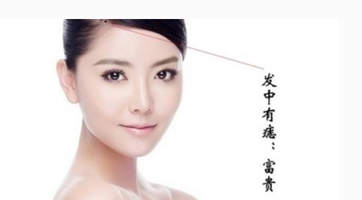 容易获得意外之财的痣都有哪些