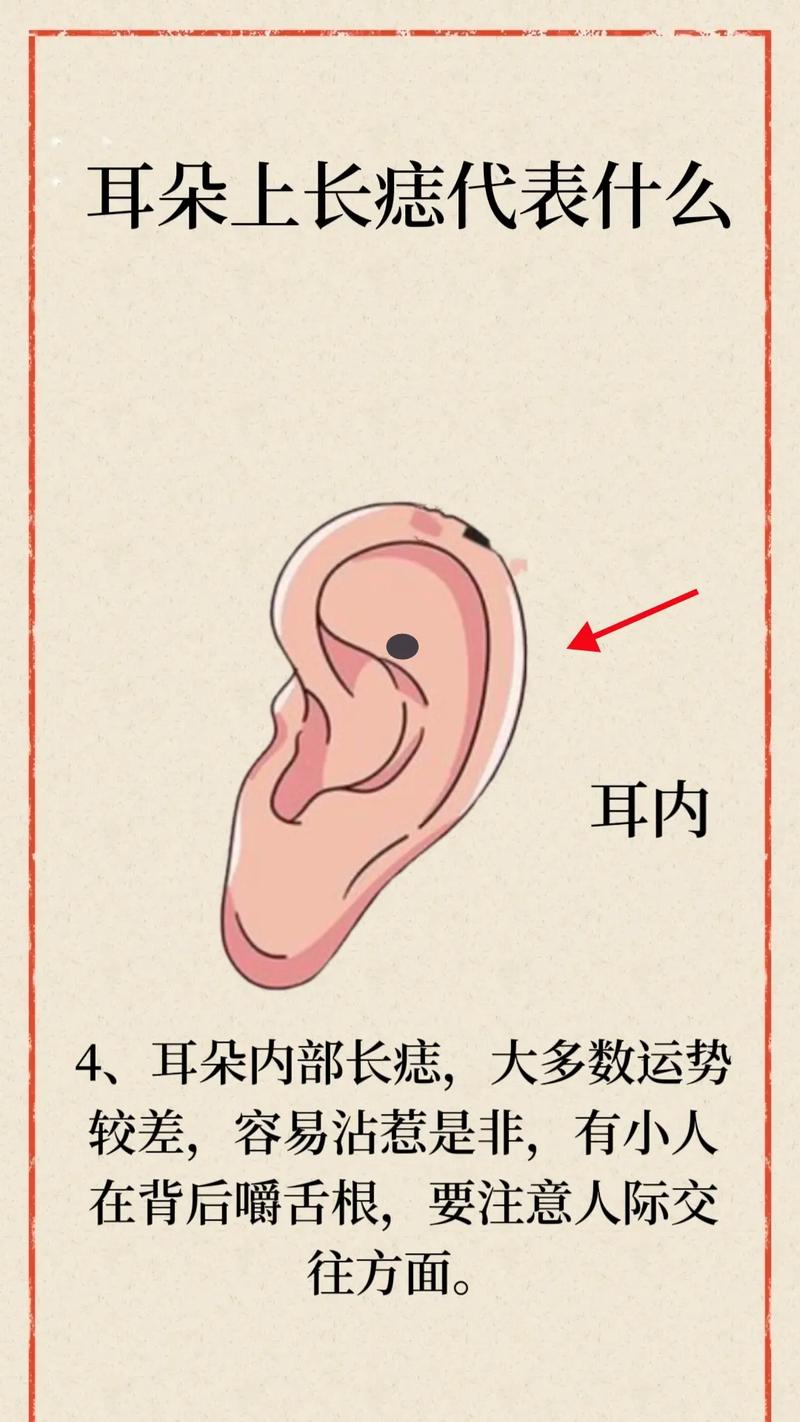 耳朵哪里的痣有福气图