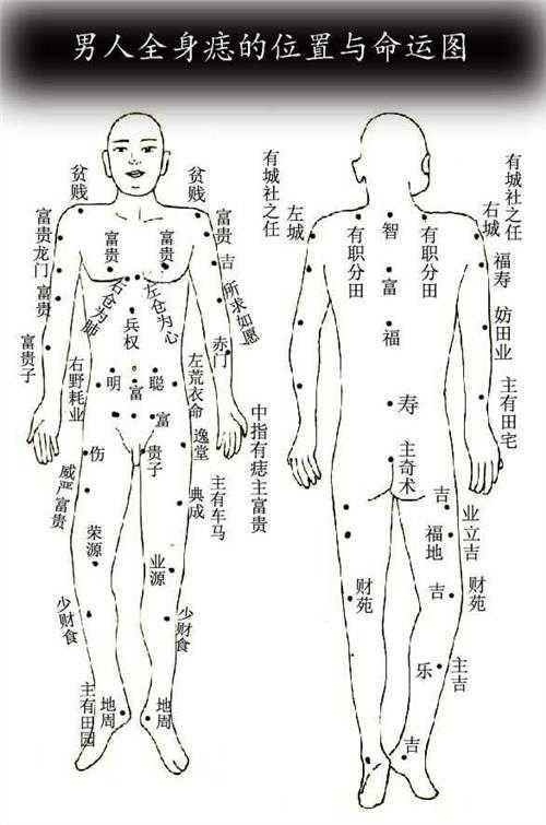 男右脚痣图解对照表