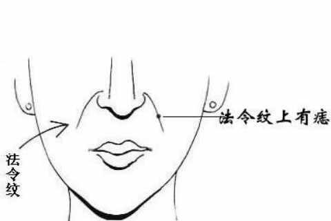 法令纹有痣预示着什么